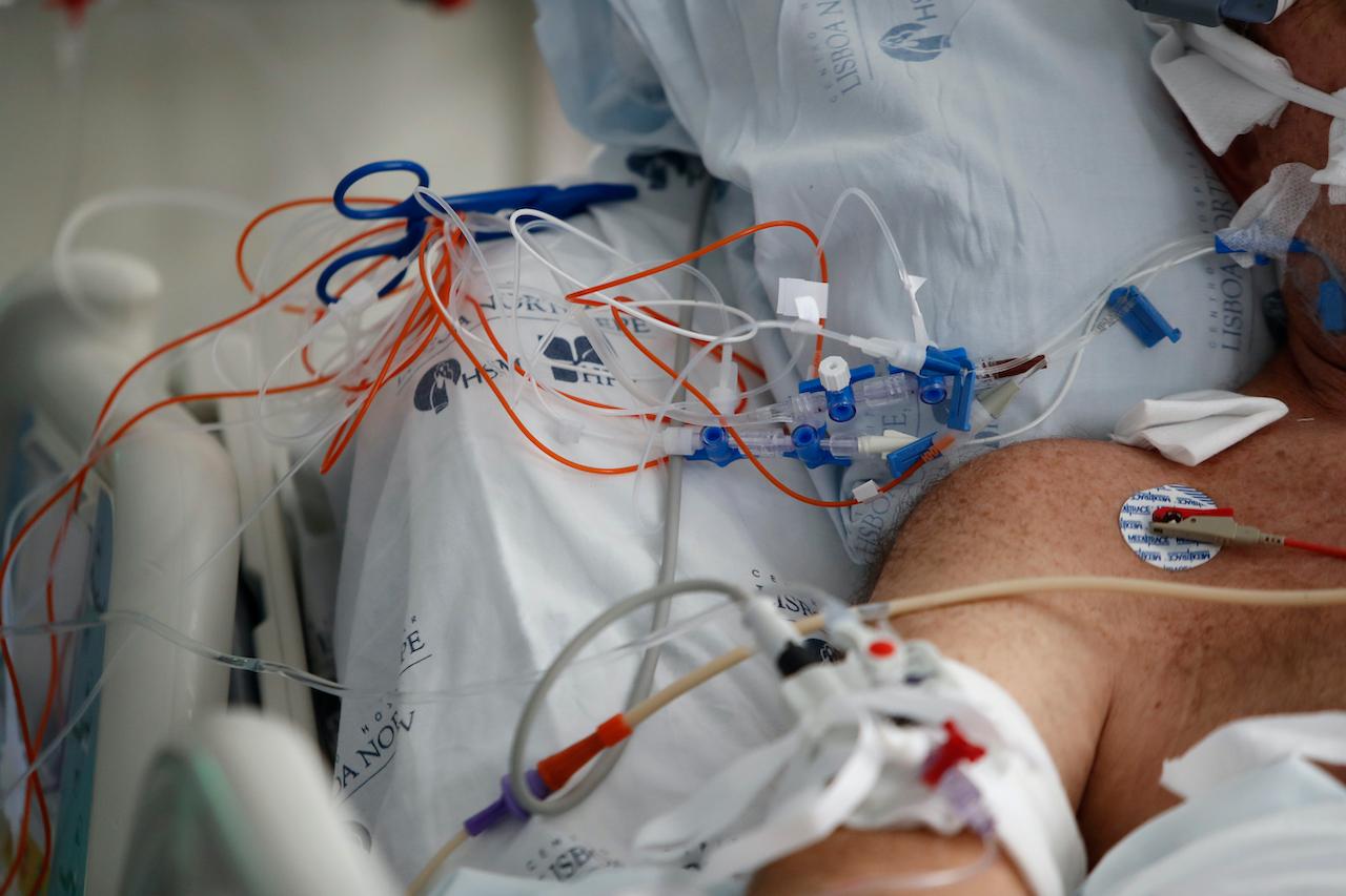 A Covid-19 patient at a hospital in Portugal is given medication through tubes. Photo: AP