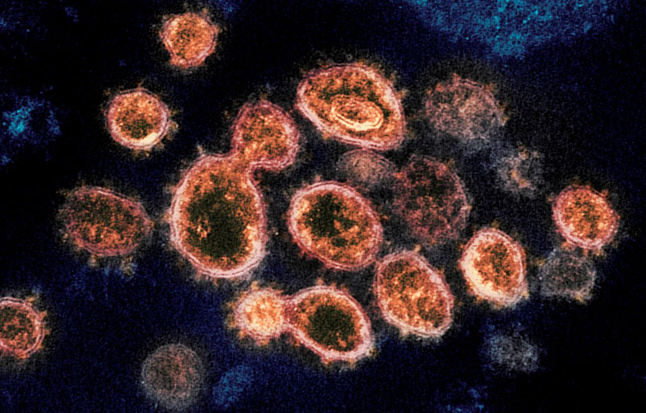 This electron microscope image shows SARS-CoV-2 virus particles which cause Covid-19, isolated from a patient in the US, emerging from the surface of cells cultured in a lab. According to two new studies released on Dec 22, 2020, people who have antibodies from infection with the coronavirus seem less likely to get a second infection for several months and maybe longer. Photo: AP
