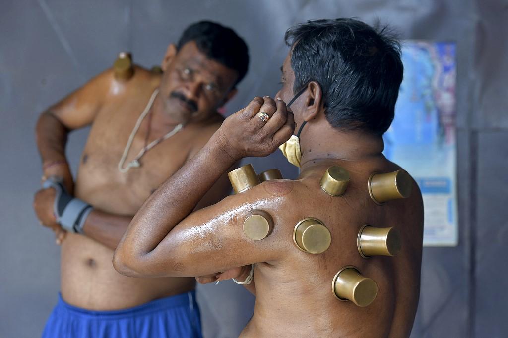 Rawatan bekam menjadi amalan tradisi di pelbagai negara, namun keberkesanannya masih diragui. Gambar: AFP