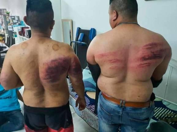 The two victims who were allegedly assaulted for fasting. Photo courtesy of PDRM