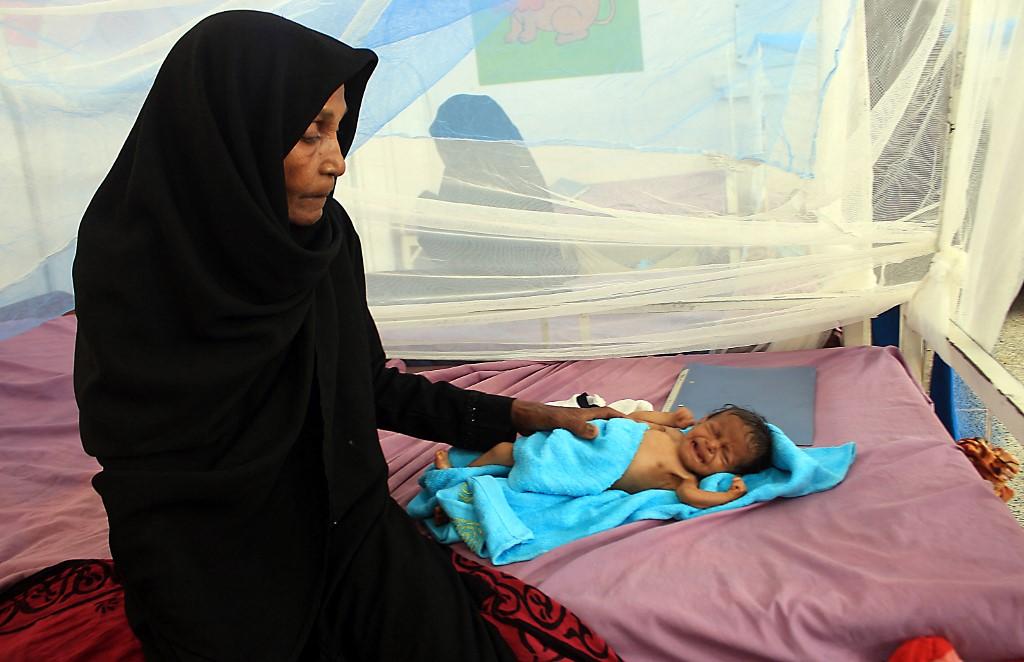 Akibat perang saudara di Yaman, jutaan penduduk negara itu terpaksa menjadi pelarian dan berdepan krisis kebuluran. Gambar: AFP